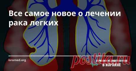 Все самое новое о лечении рака легких Ведущий израильские онкологи-пульмонологи уверяют, что, благодаря современным методикам диагностики, достижениям фармакологии, активной научно-исследовательской деятельности и нанотехнологиям, можно увеличить на 20% показатели выживаемости и выздоровления пациентов, страдающих данной формой рака.