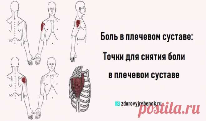 Боль в плечевом суставе: Точки для снятия боли в плечевом суставе