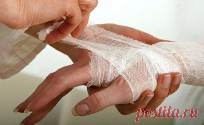 Что делать при ожогах?