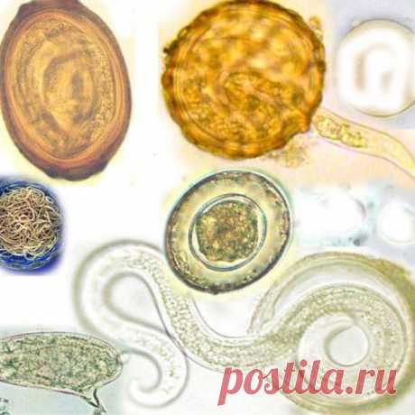 Советы врача -паразитолога