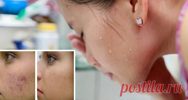 BAÑO FACIAL SÚPER SENCILLO DE DOS INGREDIENTES QUE HIDRATA, EXFOLIA Y REVIERTE LA EDAD DE LA PIEL &#8211; Hoy En Belleza