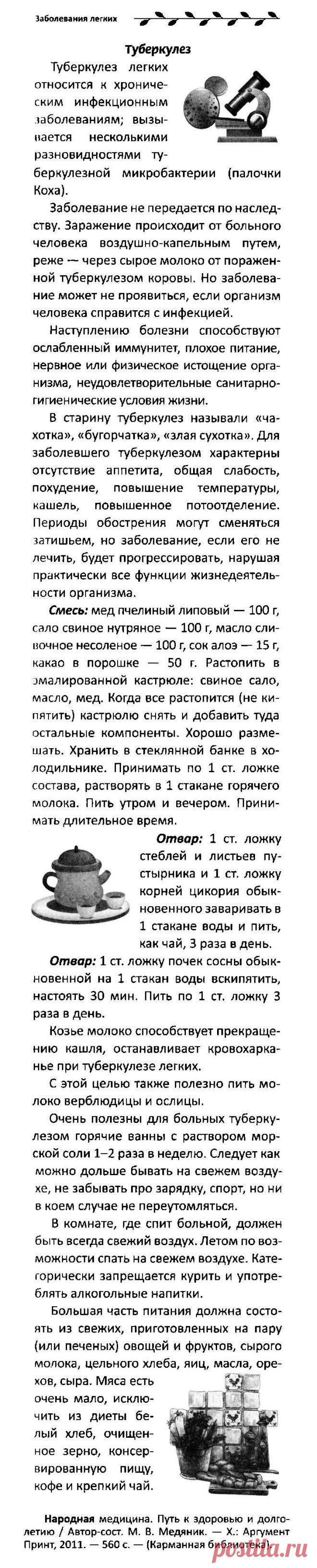 Туберкулез