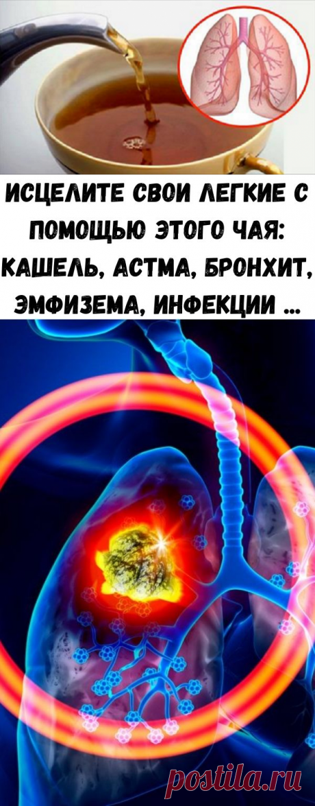 Исцелите свои легкие с помощью этого чая: кашель, астма, бронхит, эмфизема, инфекции ... - Полезные советы красоты