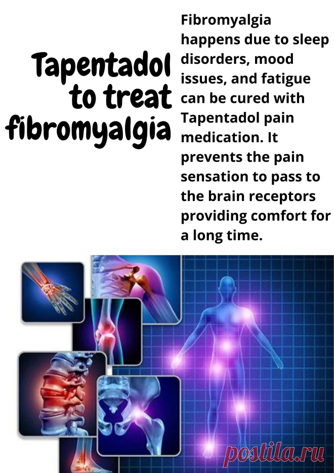 Fibromyalgia happens due to sleep disorders, mood issues, and fatigue can be cured with Tapentadol pain medication. It prevents the pain sensation to pass to the brain receptors providing comfort for a long time.