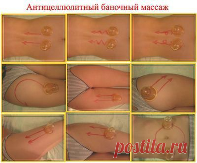 Основные принципы баночного антицеллюлитного массажа: | Perfect Body | VK