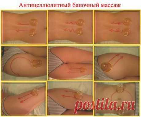 Основные принципы баночного антицеллюлитного массажа: | Perfect Body | VK