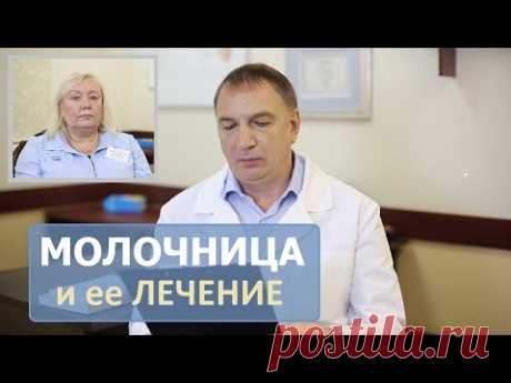 Как вылечить МОЛОЧНИЦУ у женщин и мужчин. Простые советы. Эффективные средства.