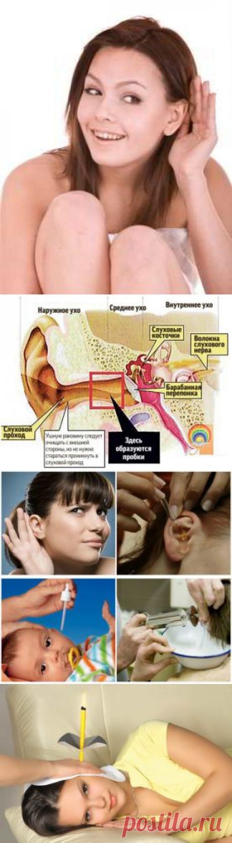 Ушные пробки и методы их удаления в домашних условиях