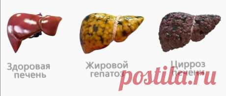 Устраняю жировой гепатоз (ожирение печени) за 10-дневный курс. Ушел живот, уменьшились отеки, посвежела кожа | Пампушка на сушке | Дзен