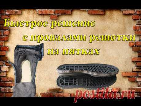 Как быстро устранить провалы на пятке