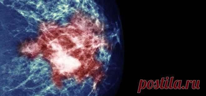 Эти продукты уменьшают риск рака молочной железы! - Полезные советы красоты
