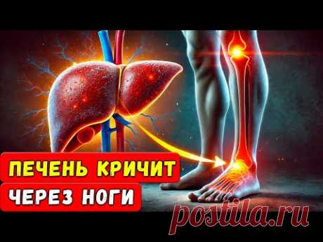 Если у вас есть ЭТИ симптомы на ногах, СРОЧНО проверьте печень! Это может стоить вам жизни!
