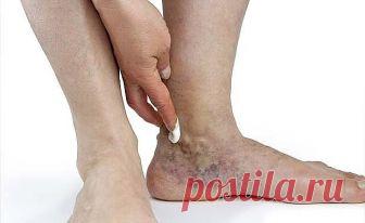 У всех дома есть это средство от варикоза, но никто о нем не знает
Почти каждый из нас знает, что такое варикоз. Эти «паучьи» сетки появляются на ногах, на руках, а иногда и там, где им быть вообще не следовало. Однако победное средство над варикозом есть дома у каждого. Просто не все знают, как его использовать.

Способ 1
Возьми зеленые помидоры и разрежь их попалам. Разрезом приложи к месту варикоза и оставь на 2-3 минуты. Очень важно, чтобы томаты были именно зелеными, ...