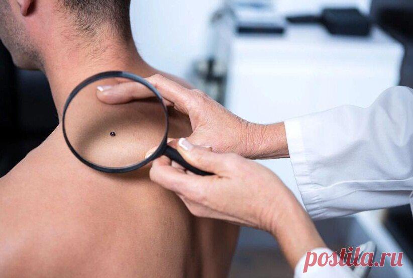 Обязательно спросите это у своего дерматолога
Рекомендуется проходить полное обследование один раз в год, чтобы не только убедиться...
Читай пост далее на сайте. Жми ⏫ссылку выше