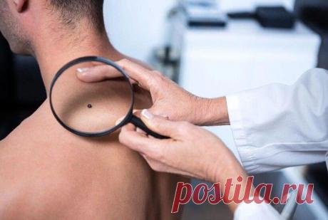 Обязательно спросите это у своего дерматолога
Рекомендуется проходить полное обследование один раз в год, чтобы не только убедиться...
Читай пост далее на сайте. Жми ⏫ссылку выше