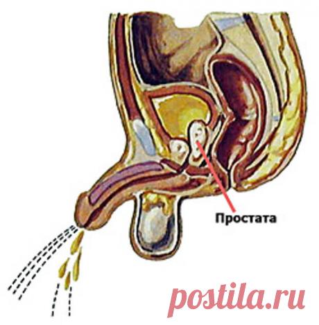 Испарилась - и забылась! Об аденоме простаты. | ПолонСил.ру - социальная сеть здоровья
