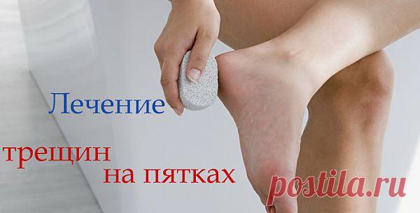 Как лечить трещины на пятках? Причины и лечение трещины на пятках &raquo; GlobusLife.ru