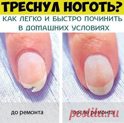 ТРЕСНУЛ НОГОТЬ? КАК ЛЕГКО И БЫСТРО ПОЧИНИТЬ В ДОМАШНИХ УСЛОВИЯХ

Если вы обожаете длинные ногти, но в самый неподходящий момент случилась неприятность и ноготь треснул, есть замечательный способ его починить.  И при этом вам не придется его обрезать!

Вот этот способ – ok.ru/group/51853341098114