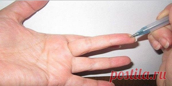 Если Вам не просто плохо, а очень плохо, надавите на точку! Точка работает 100% | Всегда в форме!
