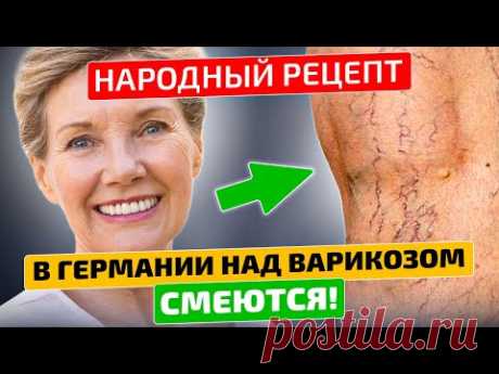 Оказывается немцы знают толк в народной медицине! Розмарин от варикоза