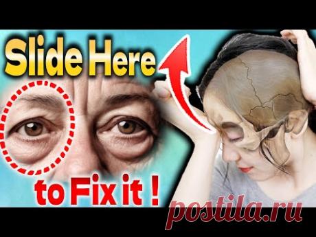 Сдвиньте орбитальные кости вверх, и тогда исчезнут опущенные веки!