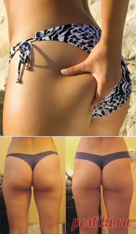 How to Tone your Hips and Thighs | Virtual Clinic