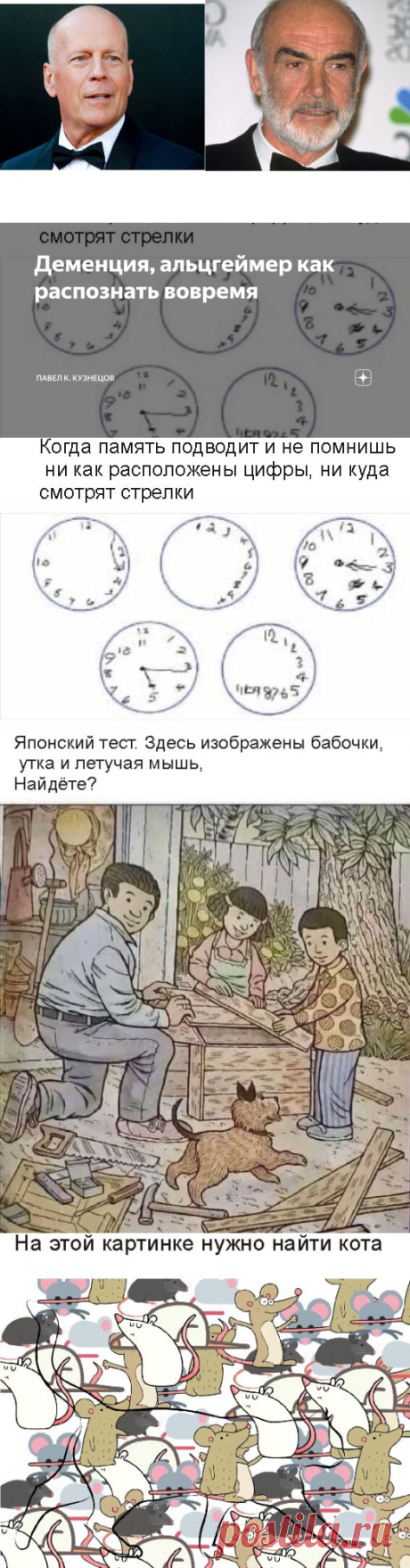 Деменция, альцгеймер как распознать вовремя | Павел К. Кузнецов | Дзен