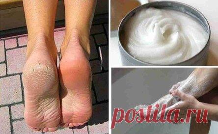 Я много лет мучался с грибком на ногах, а помог самый простой рецепт!