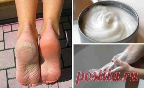 Я много лет мучался с грибком на ногах, а помог самый простой рецепт!