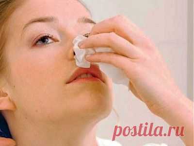 Как остановить кровотечение из носа | Я ЗДОРОВ!