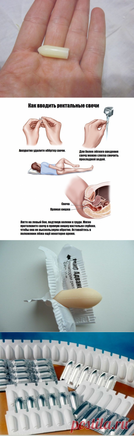 Свечи от внутреннего геморроя ⋆Список лучших по мнению врачей⋆ Отзывы