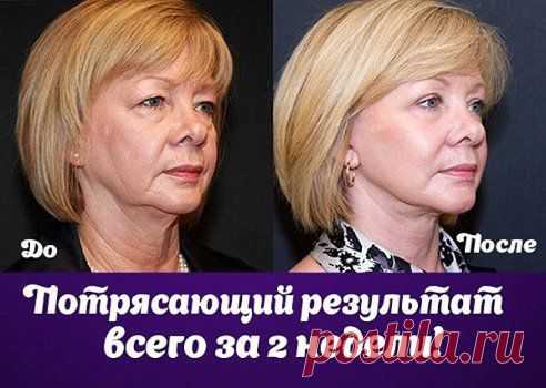 Одноклассники