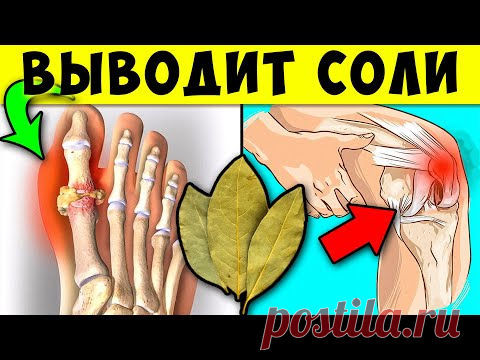 Целые комки Соли выйдут Из Суставов, если Каждый день пить по два глотка