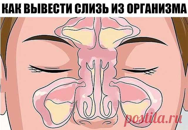 КАК ВЫВЕСТИ СЛИЗЬ ИЗ ОРГАНИЗМА И СТАТЬ ЗДОРОВЕЕ НА 10 ЛЕТ.