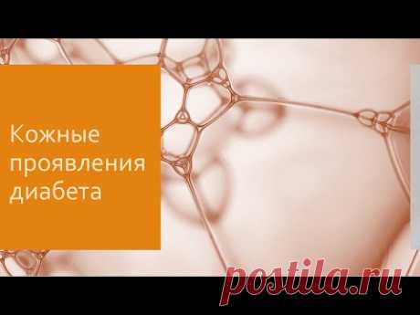 Диабет 12. Кожные проявления диабета