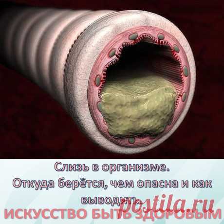 Слизь в организме. Откуда берётся, чем опасна и как выводить
Впервые слизь в нашем организме образуется еще в раннем детстве тогда, когда мы съедаем что-то вареное. По мере того как мы растем, слизь накапливается и заполняет все полости нашего тела. Самым «любимым» местом скопления для слизи являются легкие, бронхи и желудок. Когда ее собирается слишком много, она начинает подниматься выше и выходит через нос.