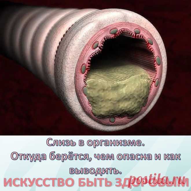 Слизь в организме. Откуда берётся, чем опасна и как выводить
Впервые слизь в нашем организме образуется еще в раннем детстве тогда, когда мы съедаем что-то вареное. По мере того как мы растем, слизь накапливается и заполняет все полости нашего тела. Самым «любимым» местом скопления для слизи являются легкие, бронхи и желудок. Когда ее собирается слишком много, она начинает подниматься выше и выходит через нос.