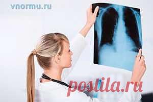 Признаки туберкулеза у взрослых на ранних стадиях