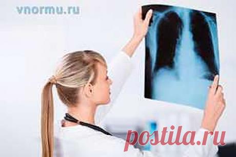 Признаки туберкулеза у взрослых на ранних стадиях