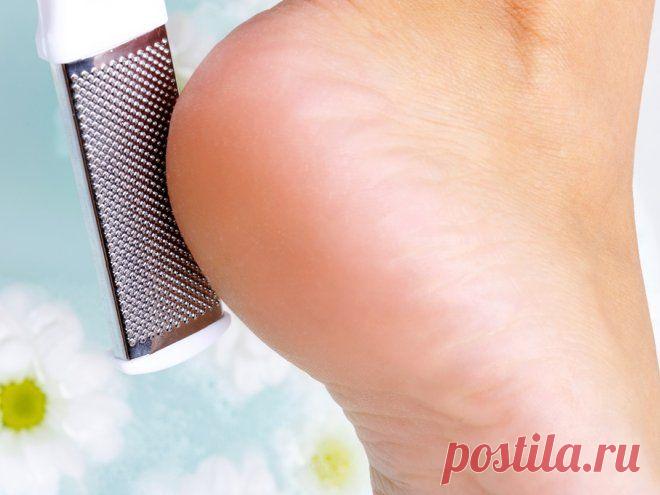 От трещин пяток помогают проверенные народные средства | Дамский эксперт