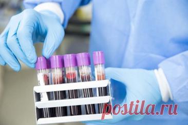 Снизить «плохой» холестерин поможет черный тмин Черный тмин хорош известен и как традиционная специя, и как медицинское средство, обладающее антиоксидантным и противовоспалительным действием. Специалисты Осакского университета выяснили, что эта приправа ещё и помогает справляться с ожирением и снижать «плохой» холестерин. Работа...