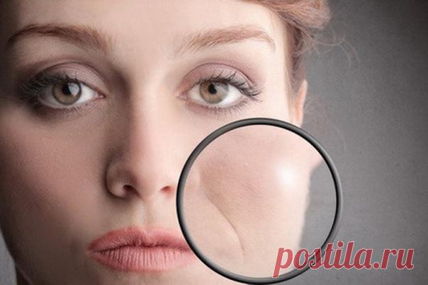 КАК ИЗБАВИТЬСЯ ОТ НОСОГУБНЫХ СКЛАДОК

Носогубные складки рано или поздно появляются у каждой женщины. Хотим мы этого или нет, но они неизбежны. Вещь это довольно неприятная: мимические морщины придают лицу уставший вид, зрительно старят его и выглядят не эстетично.