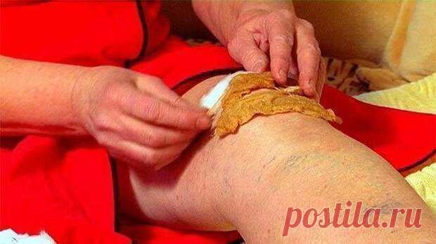 Болит ТАЗОБЕДРЕННЫЙ СУСТАВ и отдает в ногу? Вот что поможет...НАСТОЙКИ цветков сирени,одуванчика,БЫЧЬЯ ЖЕЛЧЬ.