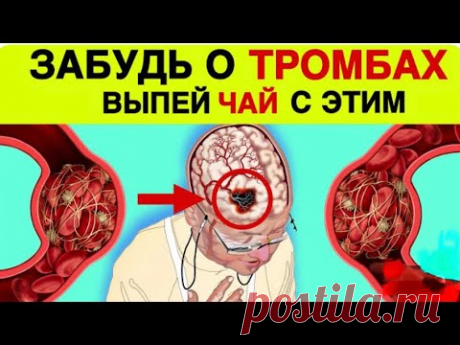 РАЗЖИЖАЮТ ЛУЧШЕ АСПИРИНА | НАВСЕГДА ЗАБУДЬ о ТРОМБАХ и ГУСТОЙ КРОВИ….