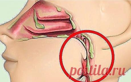 СЛИЗЬ В ОРГАНИЗМЕ. 
ОТКУДА БЕРЁТСЯ, ЧЕМ ОПАСНА И КАК ВЫВОДИТЬ. 

Впервые слизь в нашем организме образуется еще в раннем детстве тогда, когда мы съедаем что-то вареное. 
По мере того как мы растем, слизь накапливается 
и заполняет все полости нашего тела. Самым «любимым» местом скопления для слизи являются легкие, бронхи и желудок. 

Когда ее собирается слишком много, она начинает подниматься выше и выходит через нос. 
Как правило, очень часто мамы маленьких детей думают, ...