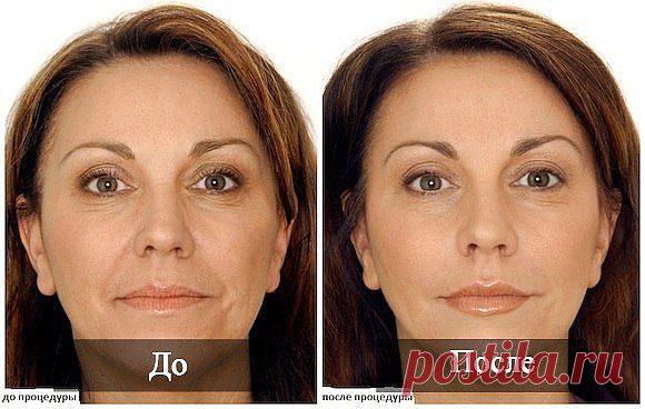 Пилинг лица в домашних условиях.