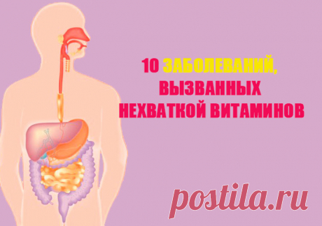 10 ЗАБОЛЕВАНИЙ, вызванных нехваткой ВИТАМИНОВ