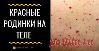 Красные родинки на теле - причины и что делать Красные родинки на теле - причины и что делать
От моего клиента пришел такой вопрос:

