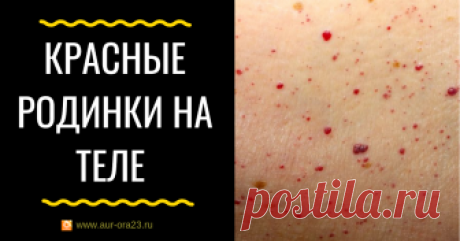Красные родинки на теле - причины и что делать Красные родинки на теле - причины и что делать
От моего клиента пришел такой вопрос:

"У женщины постоянно появляются родники на теле (красные и коричневые). В чем может быть причина и можно ли избавиться от них с помощью Пограничной Воды и других продуктов Авроры?"