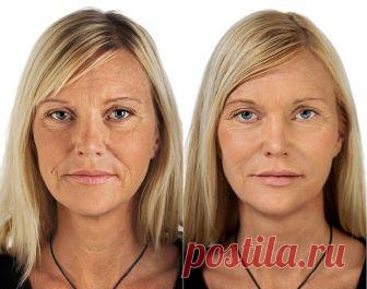 Как убрать носогубные складки: лучший способ даже против самых глубоких морщин | Все о косметике | Яндекс Дзен